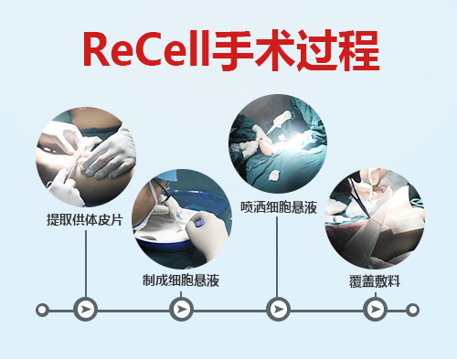 北京协和专家来院开展ReCell手术暨春季手术精准化评估