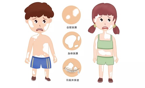 白癜风重点实验室大型公益行动,招募详情发布!